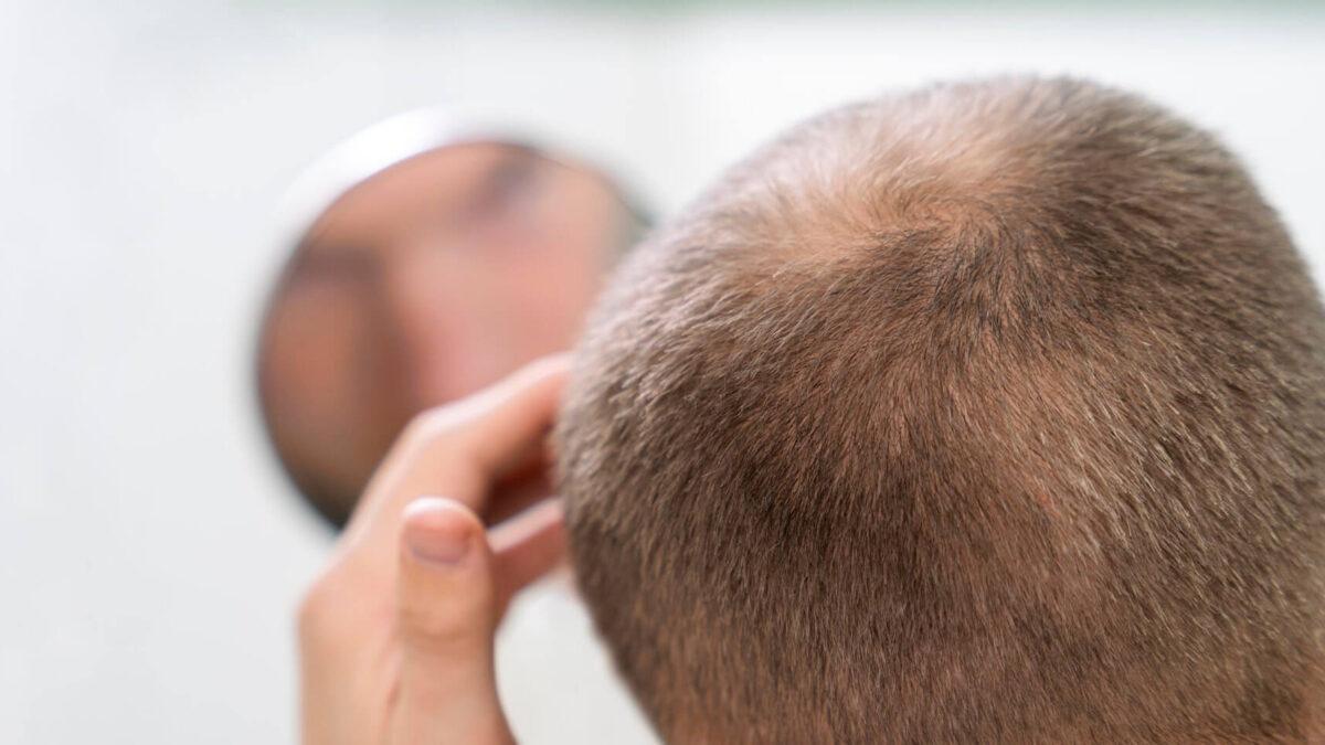 ¿Cómo cuidar el cabello de manera adecuada y evitar su caída?